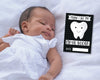 Monochrome Black and White 1st Year Milestone Cards - Baby Keepsake